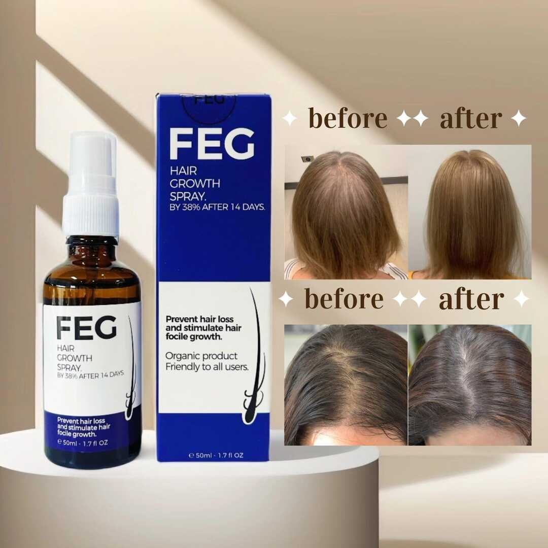 FEG Plus Hair Growth Spray + Free Derma Roller | UAE
